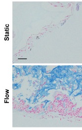 Intestine-on-a-chip for Drug Metabolism and Infectious Disease Modeling